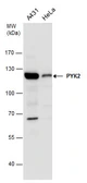 Anti-PYK2 antibody used in Western Blot (WB). GTX130887