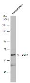 Anti-DMT1 antibody used in Western Blot (WB). GTX130889