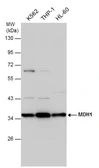 Anti-MDH1 antibody used in Western Blot (WB). GTX130900
