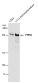 Anti-PTPRJ antibody used in Western Blot (WB). GTX130904