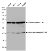 Anti-CLN5 antibody used in Western Blot (WB). GTX130920