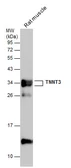 Anti-Troponin T fast skeletal antibody used in Western Blot (WB). GTX130922