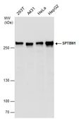 Anti-SPTBN1 antibody used in Western Blot (WB). GTX130935