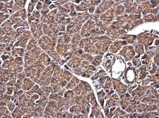 Anti-SPTBN1 antibody used in IHC (Paraffin sections) (IHC-P). GTX130935