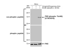Anti-PKR antibody used in Western Blot (WB). GTX130941