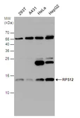Anti-RPS12 antibody used in Western Blot (WB). GTX130942
