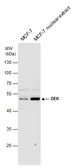 Anti-DEK antibody used in Western Blot (WB). GTX130963