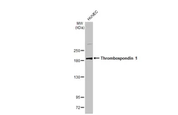 Anti-Thrombospondin 1 antibody used in Western Blot (WB). GTX130967