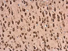Anti-RPL22 antibody used in IHC (Paraffin sections) (IHC-P). GTX130972