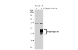 Anti-Tristetraprolin antibody used in Western Blot (WB). GTX130974