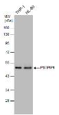 Anti-PSTPIP1 antibody used in Western Blot (WB). GTX131024