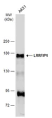 Anti-LRRFIP1 antibody used in Western Blot (WB). GTX131026