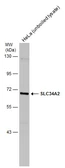 Anti-SLC34A2 antibody used in Western Blot (WB). GTX131043