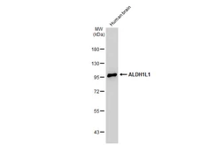 Anti-ALDH1L1 antibody used in Western Blot (WB). GTX131047