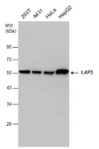 Anti-LAP3 antibody used in Western Blot (WB). GTX131074