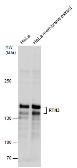 Anti-RTN3 antibody used in Western Blot (WB). GTX131091