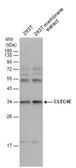 Anti-CLEC4E antibody used in Western Blot (WB). GTX131096