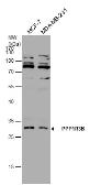 Anti-PPP1R3B antibody used in Western Blot (WB). GTX131132