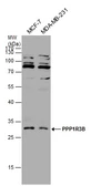 Anti-PPP1R3B antibody used in Western Blot (WB). GTX131132