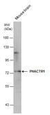 Anti-PHACTR1 antibody used in Western Blot (WB). GTX131152