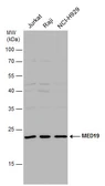 Anti-MED19 antibody used in Western Blot (WB). GTX131181