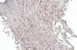 Anti-RIP3 antibody used in IHC (Paraffin sections) (IHC-P). GTX131188