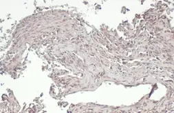 Anti-RIP3 antibody used in IHC (Paraffin sections) (IHC-P). GTX131188