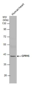 Anti-GPR15 antibody used in Western Blot (WB). GTX131192