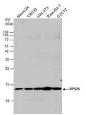 Anti-RPS26 antibody used in Western Blot (WB). GTX131193