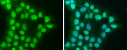 Anti-Wilms Tumor 1 antibody used in Immunocytochemistry/ Immunofluorescence (ICC/IF). GTX131203