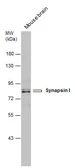 Anti-Synapsin I antibody used in Western Blot (WB). GTX131233