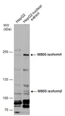 Anti-MBD5 antibody used in Western Blot (WB). GTX131242
