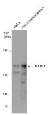 Anti-MAML2 antibody used in Western Blot (WB). GTX131250