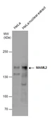 Anti-MAML2 antibody used in Western Blot (WB). GTX131250