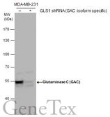 Anti-Glutaminase C (GAC) antibody used in Western Blot (WB). GTX131263