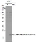 Anti-Hepatitis C virus Core Antigen antibody used in Western Blot (WB). GTX131265