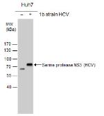 Anti-Hepatitis C virus NS3 protein antibody used in Western Blot (WB). GTX131269