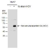 Anti-Hepatitis C virus NS5A protein antibody used in Western Blot (WB). GTX131272
