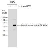Anti-Hepatitis C virus NS5A protein antibody used in Western Blot (WB). GTX131272