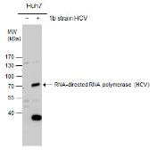 Anti-Hepatitis C virus NS5B protein antibody used in Western Blot (WB). GTX131273