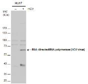 Anti-Hepatitis C virus NS5B protein antibody used in Western Blot (WB). GTX131274