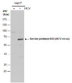 Anti-Hepatitis C virus NS3 protein antibody used in Western Blot (WB). GTX131276