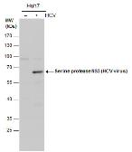 Anti-Hepatitis C virus NS3 protein antibody used in Western Blot (WB). GTX131276