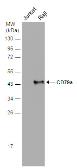 Anti-CD79a antibody used in Western Blot (WB). GTX131291