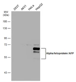 Anti-Alpha fetoprotein / AFP antibody used in Western Blot (WB). GTX131311