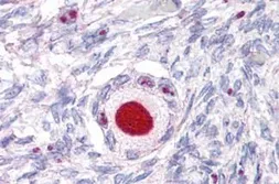 Anti-Steroidogenic Factor 1 antibody used in IHC (Paraffin sections) (IHC-P). GTX13132