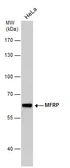 Anti-MFRP antibody used in Western Blot (WB). GTX131340