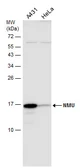 Anti-NMU antibody used in Western Blot (WB). GTX131391