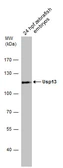 Anti-Usp13 antibody used in Western Blot (WB). GTX131403