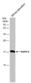 Anti-Leptin b antibody used in Western Blot (WB). GTX131406
